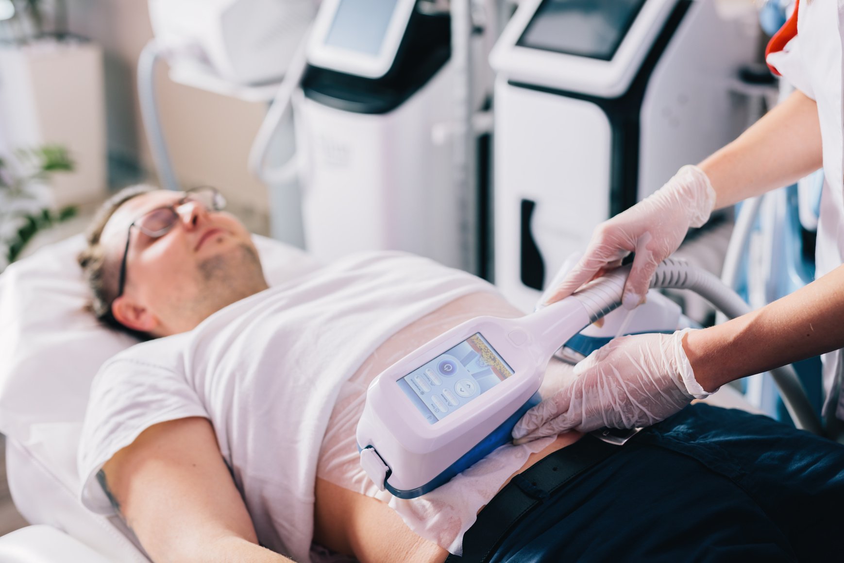 Man Undergoing Cryolipolysis Fat Removal Treatment on Belly